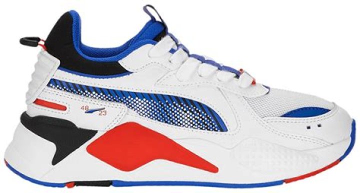 Anya Chalotra Plastic Surgery: Did She Undergo Cosmetic Surgery?